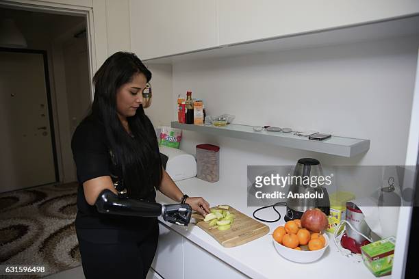 Amputee Zubeyde Nisa Karabacak, 26-years-old, slices an apple with her "bionic arm" named "Revo" during an exclusive interview at her home in...