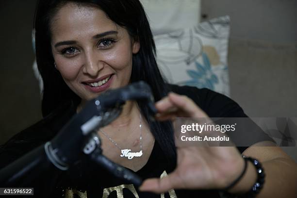 Amputee Zubeyde Nisa Karabacak, 26-years-old, is seen with her "bionic arm" named "Revo" during an exclusive interview at her home in Gaziantep,...