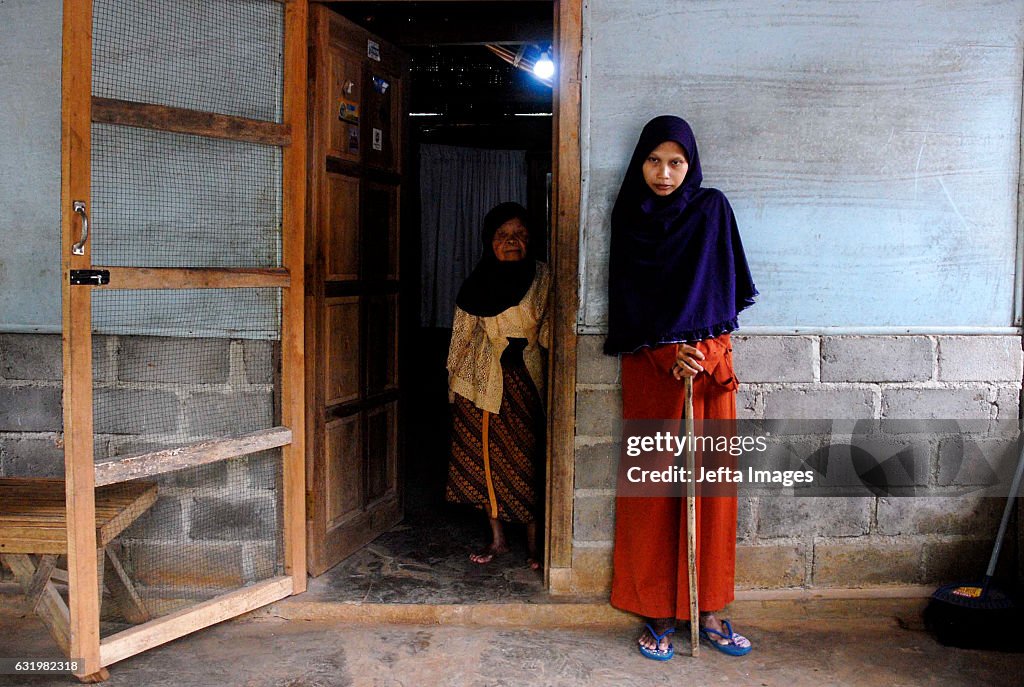 Sulami, An Indonesian Woman Suffering From Spine Bamboo