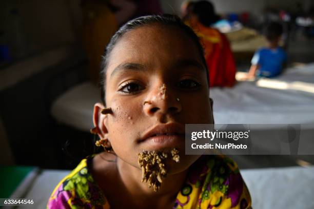 In this photograph taken on January 30 Bangladeshi patient Sahana Khatun poses for a photograph at the Dhaka Medical College and Hospital. A young...