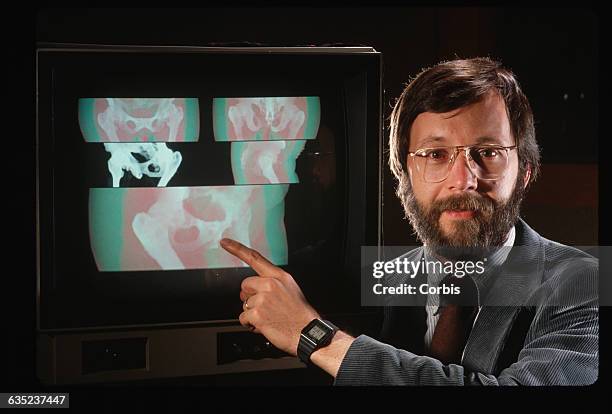 Edwin Catmull Computer Science 694 Male Pelvis Vs Female Pelvis Stock Photos, High-Res Pictures, and ...