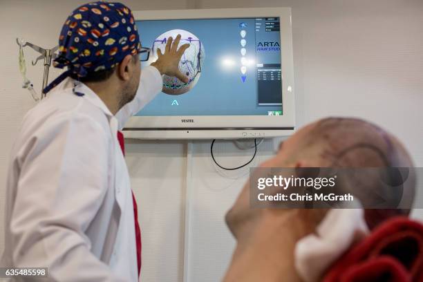 Doctor explains a hair transplant procedure to a patient at the luxury Esteworld Clinic on February 15, 2017 in Istanbul, Turkey. Esteworld clinic is...