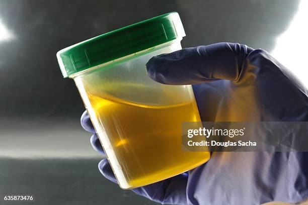 drug testing lab technician holding a urine sample - cholesterol test stock pictures, royalty-free photos & images