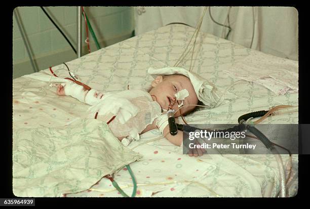 Soviet newborn is hooked up to intravenous equipment in an intensive care unit in Tula, USSR. | Location: Tula, USSR.