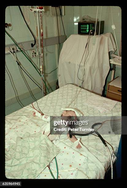 Soviet newborn is hooked up to intravenous equipment in an intensive care unit in Tula, USSR. | Location: Tula, USSR.