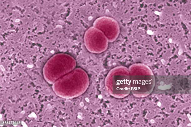 Meningococcus seen under a scanning electron microscope.