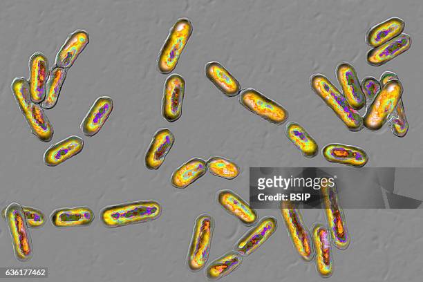 Clostridium difficile seen under optical microscopy.