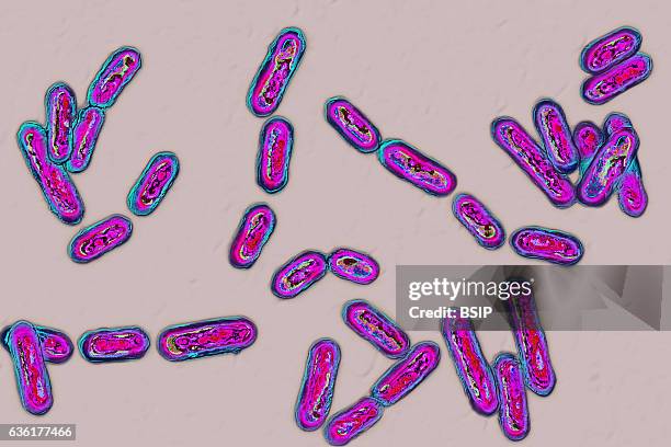 Clostridium difficile seen under optical microscopy.