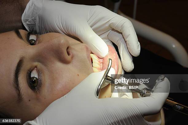 Gingival graft. Preparing the gum before the operation : deep tartar removal and polishing the roots. Deep tartar removal allows germs to be...