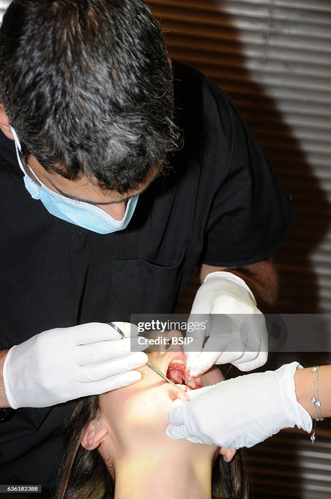 Gingival graft