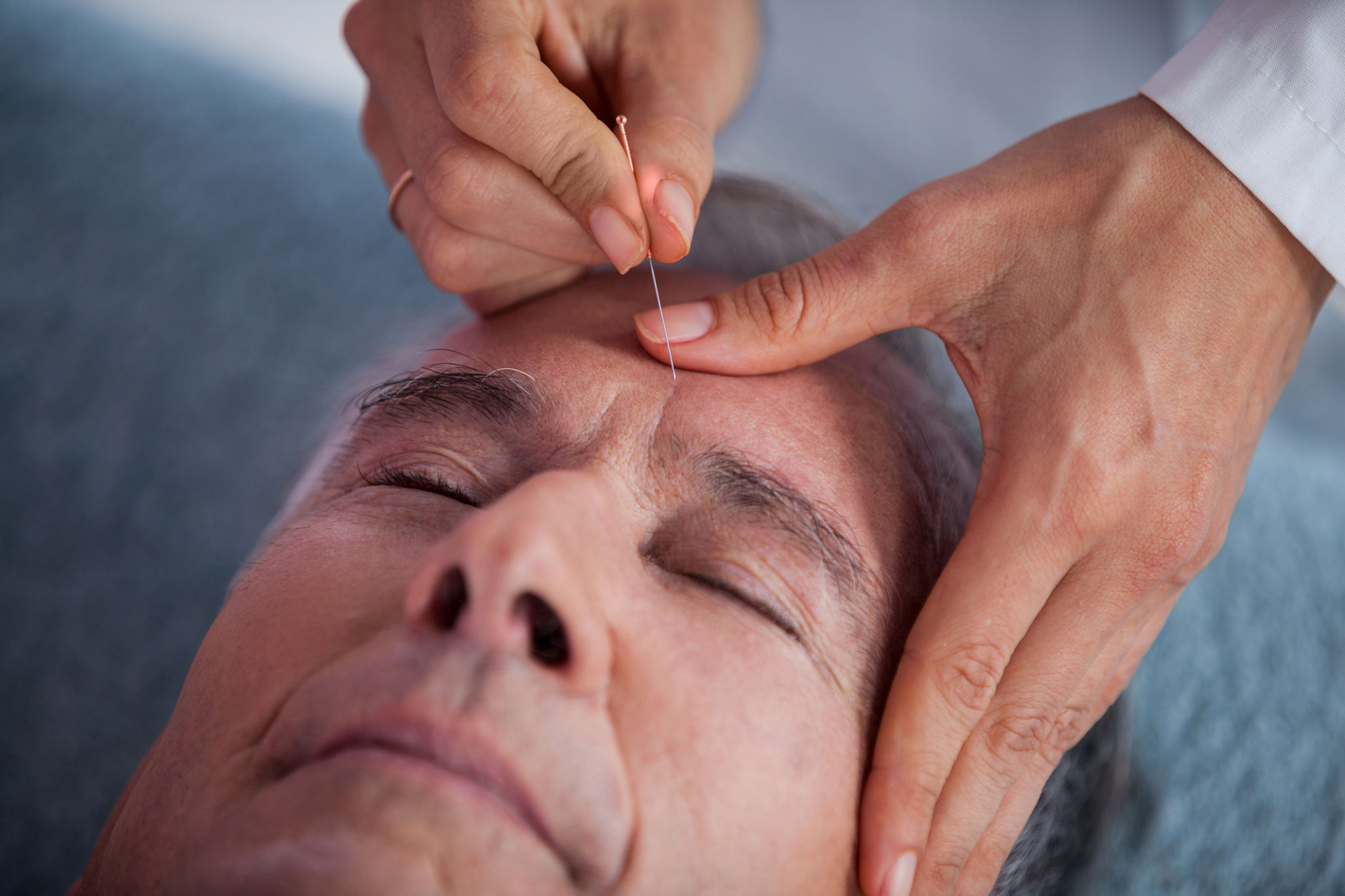 acupuncture practitioner