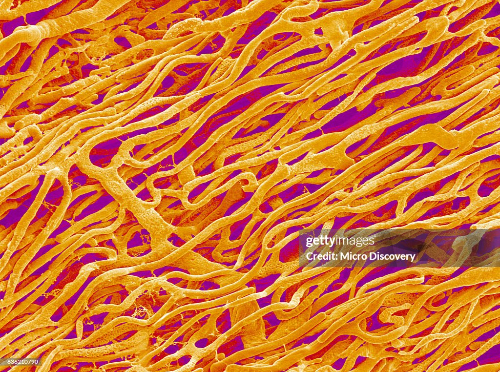 Blood Vessel Cast in Heart of a Rat