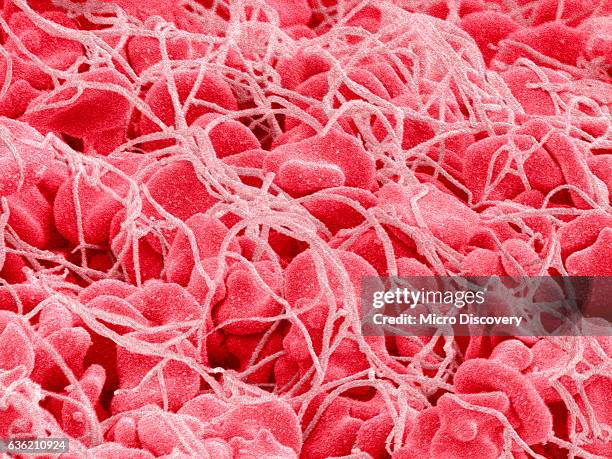 coagulated human red blood cells - coágulo de sangre fotografías e imágenes de stock