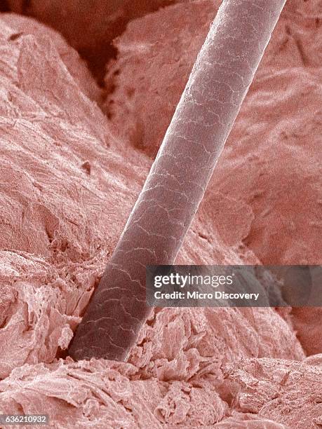 human hair and skin - human hair microscope stock pictures, royalty-free photos & images