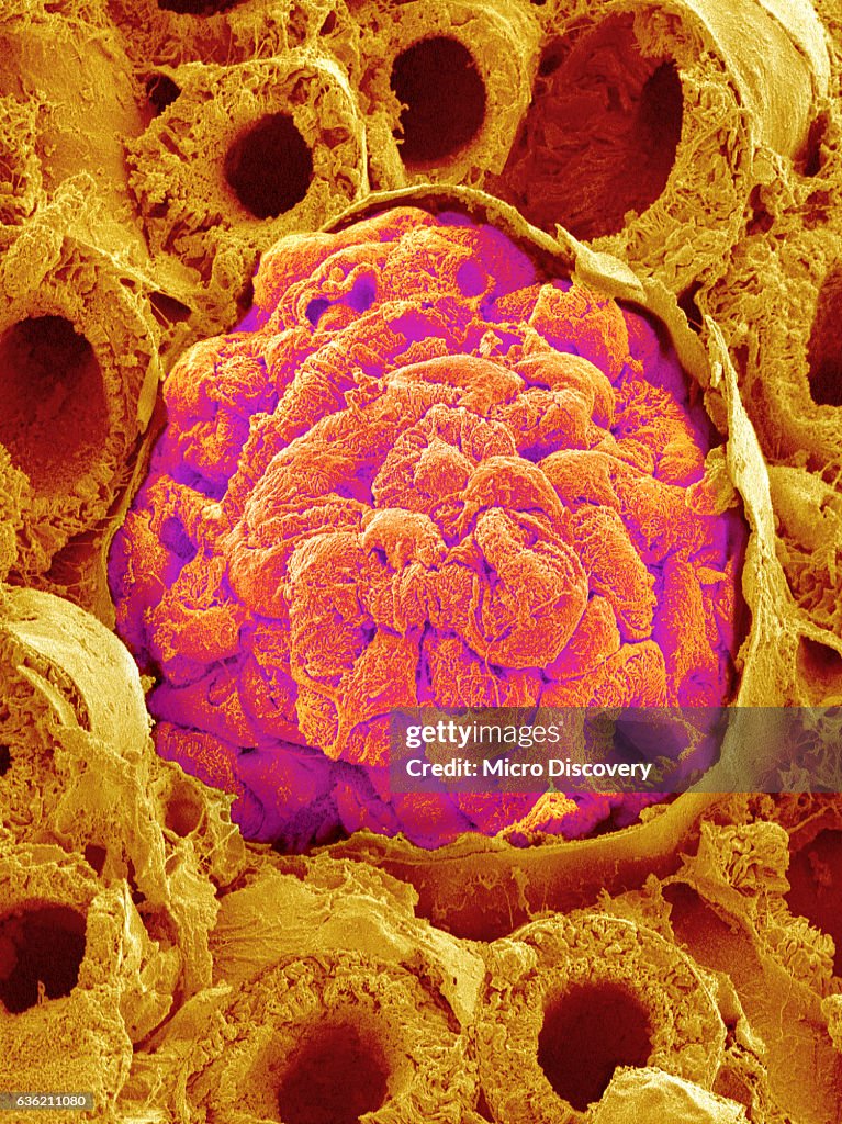 Glomerulus from Rat Kidney