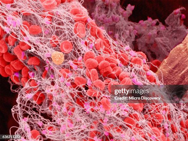 scanning electron micrograph of a blood clot in human blood - blutgerinnsel stock-fotos und bilder