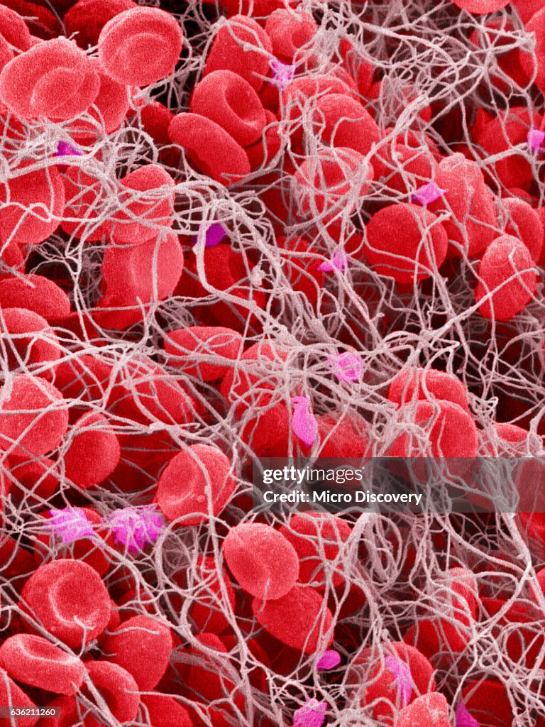 Blood clots