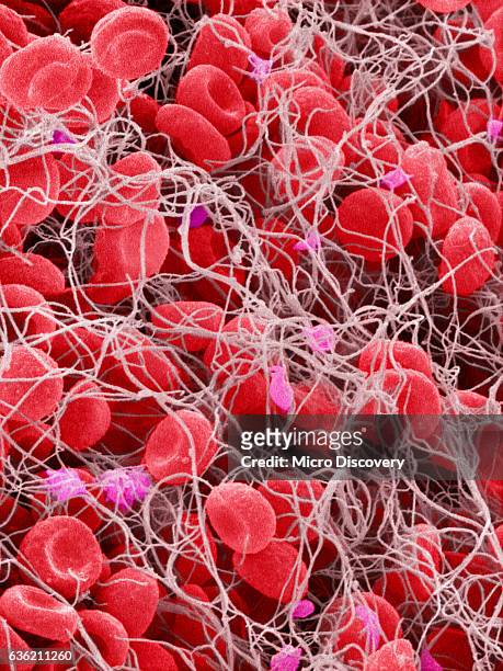 blood clots - blood clot 個照片及圖片檔