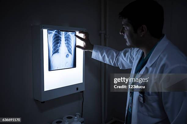 rayos x de doctor looking - human anatomy organs back view fotografías e imágenes de stock
