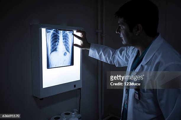 doctor looking xray - human lung stock pictures, royalty-free photos & images