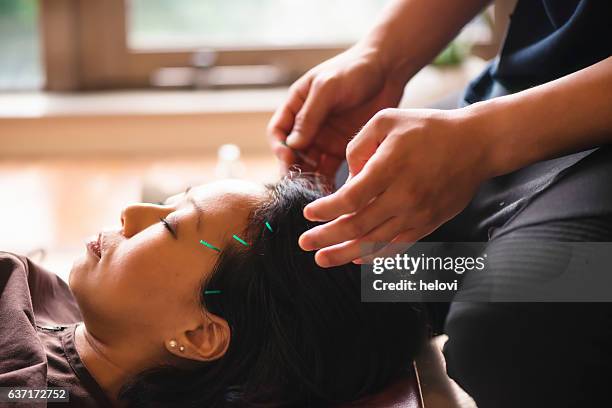 young woman at the acupuncture treatment - mature woman herbs stock pictures, royalty-free photos & images