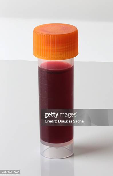 sealed vial of blood for lab testing - cholesterol test stock pictures, royalty-free photos & images