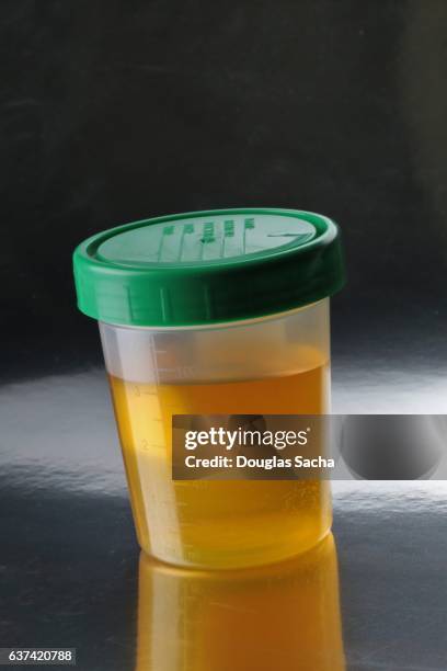 submitting a urine sample to the testing clinic - cholesterol test stock pictures, royalty-free photos & images