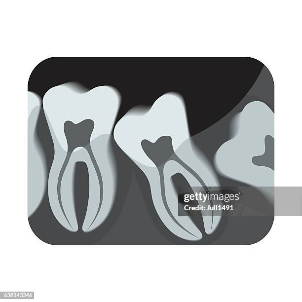 ilustraciones, imágenes clip art, dibujos animados e iconos de stock de radiografía en blanco y negro de los dientes humanos. vector - radiologia dental
