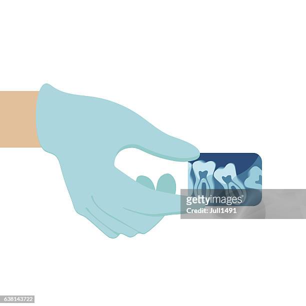 blue x-ray of human teeth in the hand - rubber gloves stock illustrations