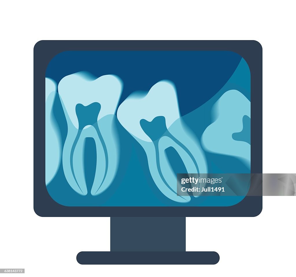 Computer With Teeth Xrays Of The Tooth On The Computer Vector Illustration High-Res Vector ...