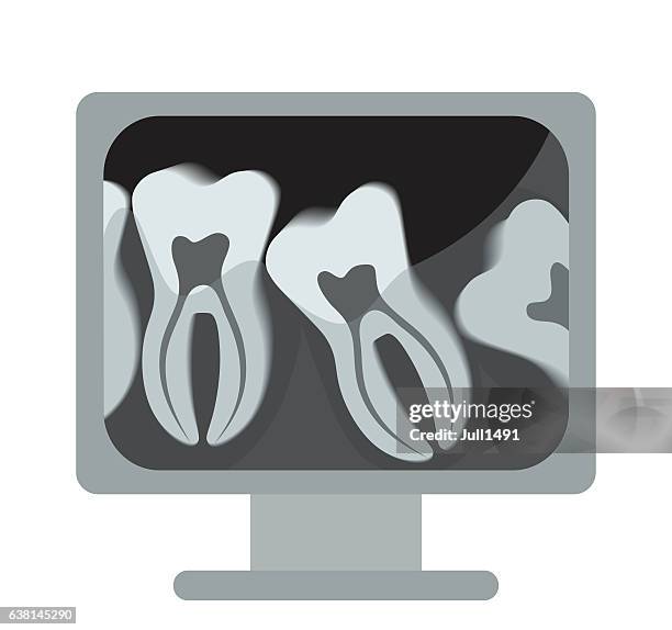 x-rays of the tooth on the computer. vector, - dentist computer stock illustrations
