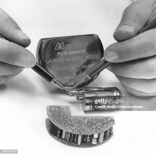 Epoxy Pacemaker Pacemaker Hand Photos and Premium High Res Pictures - Getty Images