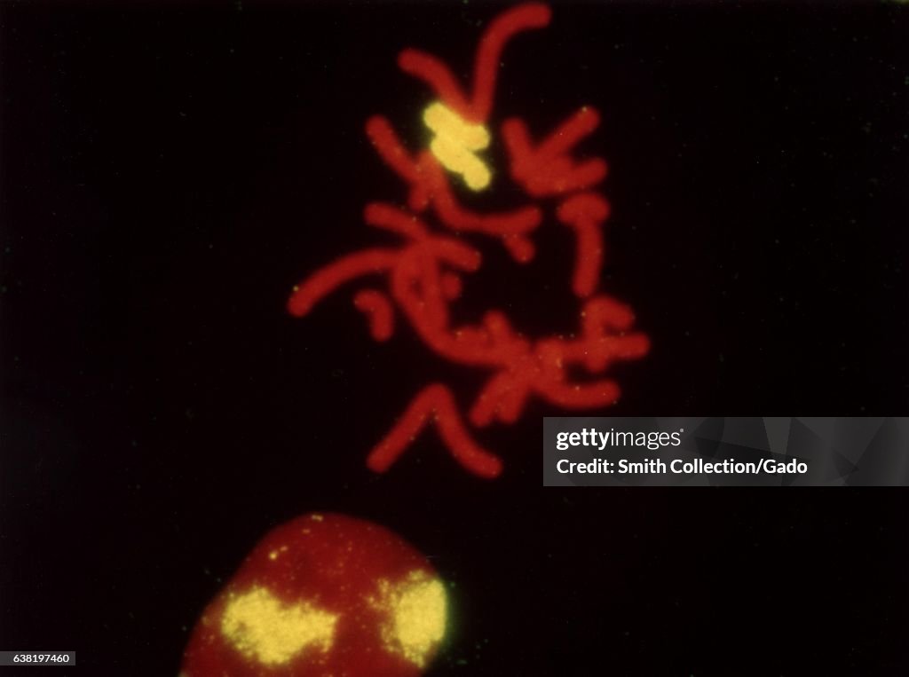 Radiation-Induced Chromosome