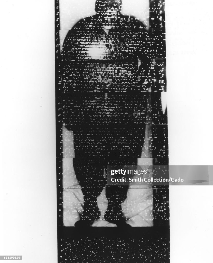 Whole Body Serial Scan