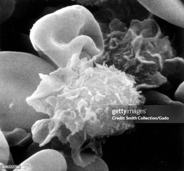 Monocyte Microscope Apr 314 Monocyte Stock Photos, High-Res Pictures, and Images - Getty Images