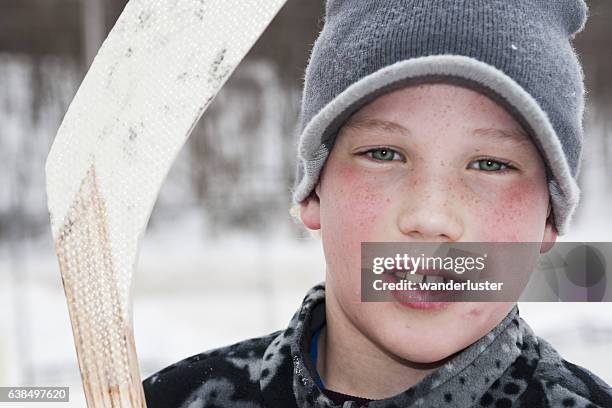 young hockey player with busted lip - sports head injuries imagens e fotografias de stock