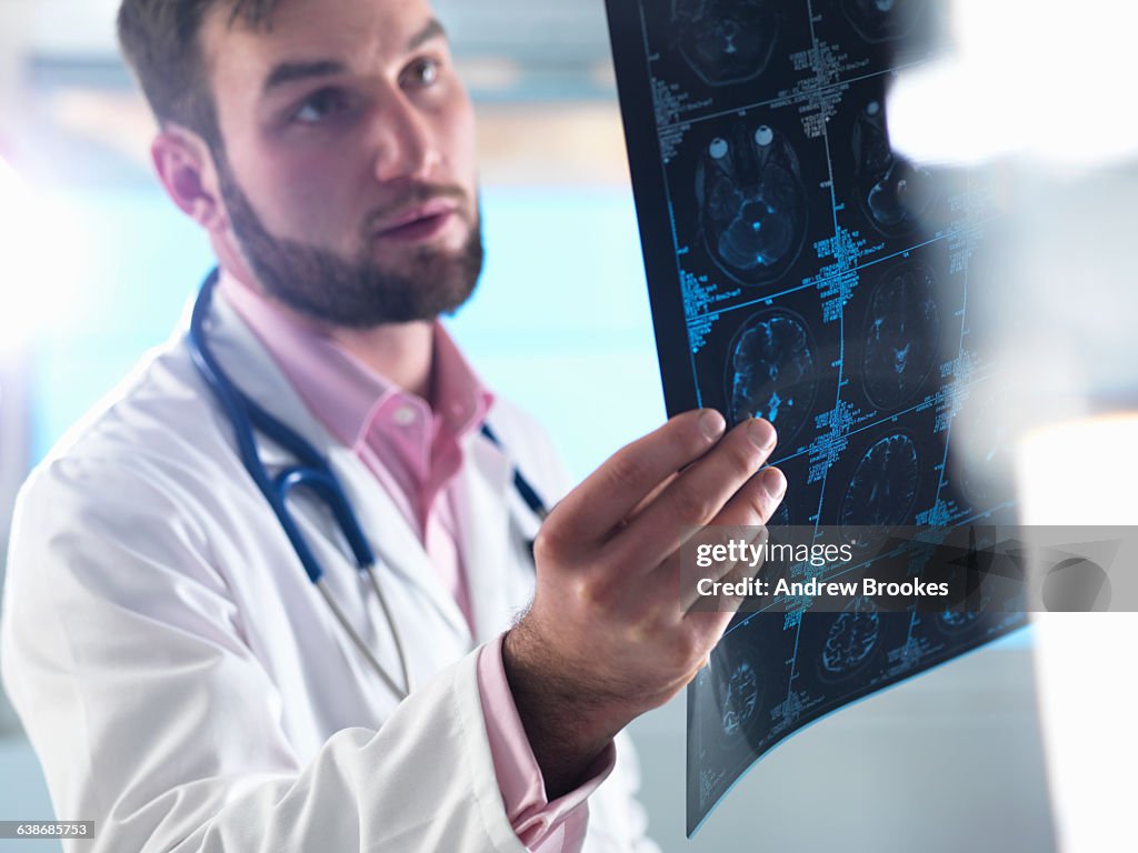 Junior doctor examining a brain scan in hospital