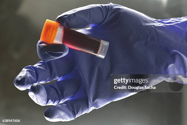 medical lab technician hold sample blood for testing - groupe sanguin photos et images de collection