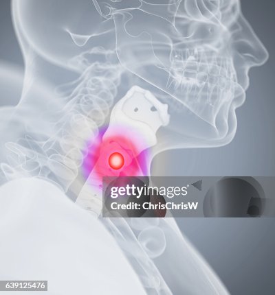 Through Pain Sore Throat Pain Human Anatomy Head Xray Like Image High-Res Vector ...