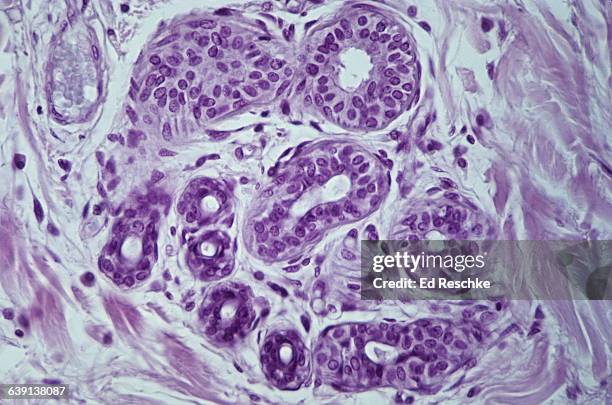 sweat glands in human scalp, magnification 100x - sebaceous gland stock pictures, royalty-free photos & images