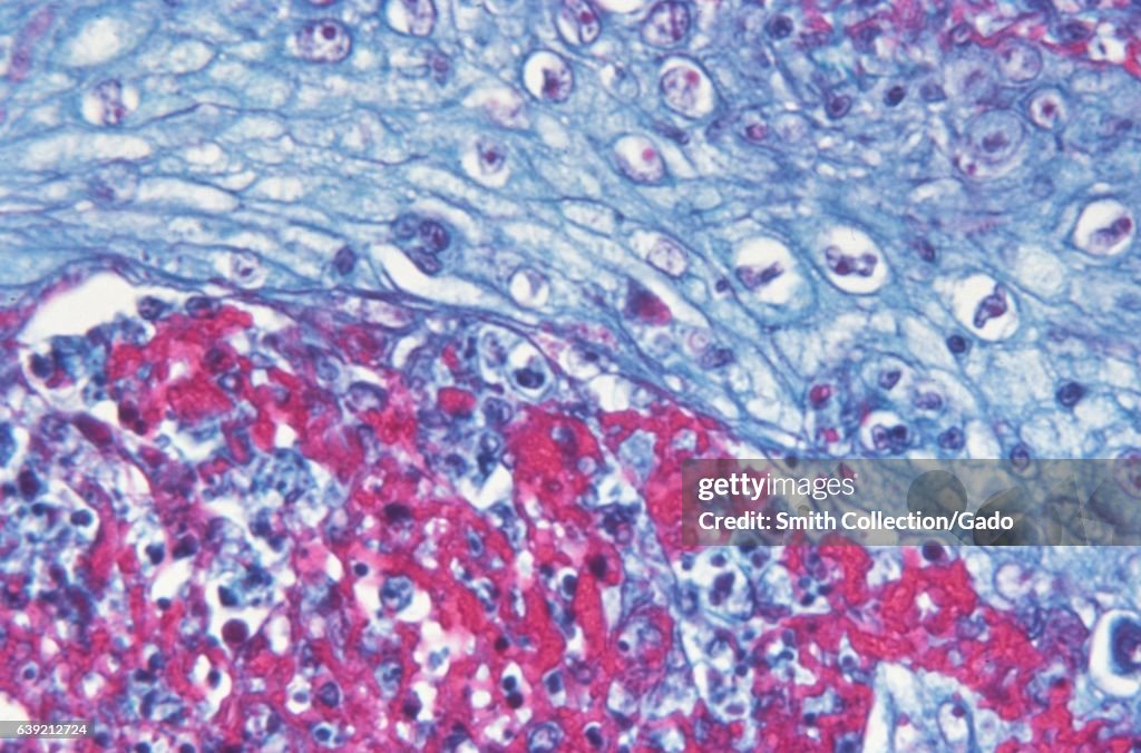 Smallpox Variola Virus