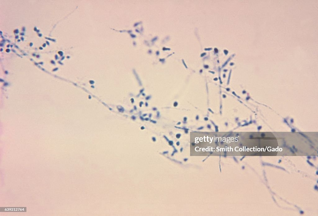 Microsporum Gypseum