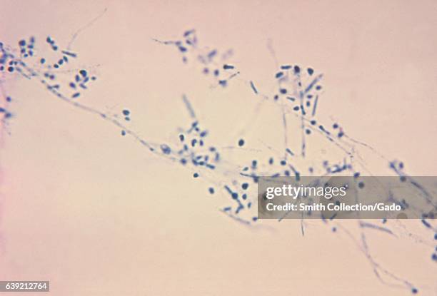 Photomicrograph of the fungus Microsporum gypseum using the lactophenol cotton blue staining technique, 1969. The dermatophyte M. Gypseum, a natural...