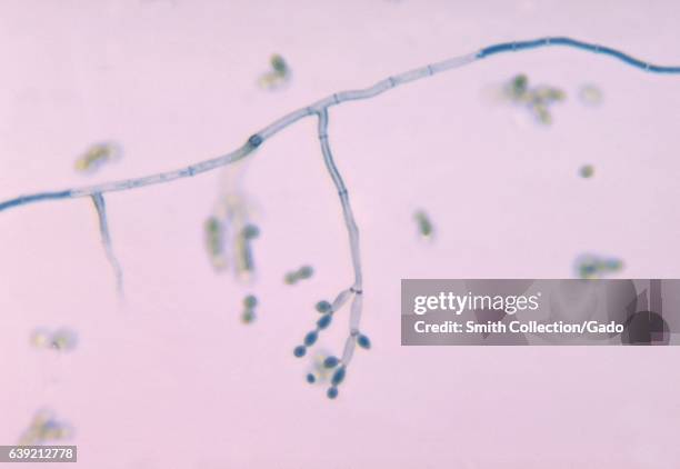 Photomicrograph of the fungus Cladosporium spp, 1969. Prepared with the lactophenol cotton blue staining technique. Image courtesy CDC/Dr. Leanor...