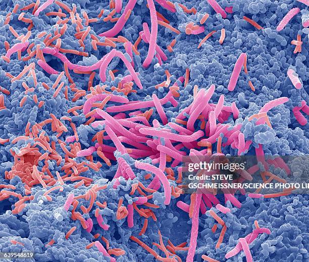 tongue bacteria, sem - micrografía científica fotografías e imágenes de stock