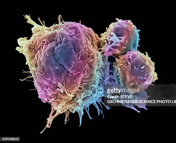 cancer cell and t lymphocytes, sem - antigeen stockfoto's en -beelden