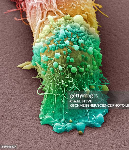 skin cancer cell, sem - melanoma stock pictures, royalty-free photos & images