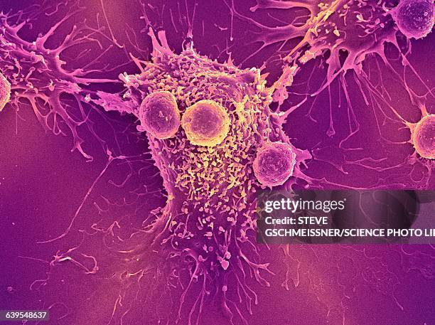 cancer cell and t lymphocytes, sem - cancer bildbanksfoton och bilder