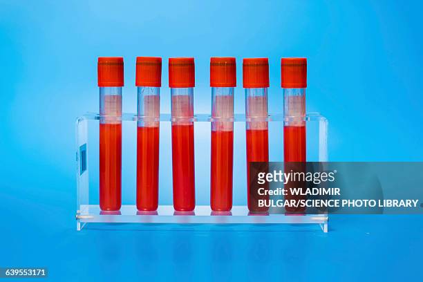 blood samples in tubes - prateleira de tubos de ensaio imagens e fotografias de stock