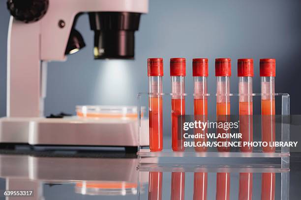 blood samples and microscope - provetta per campioni ematici foto e immagini stock